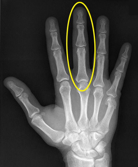 Články prstů člověka představují další příklad zlatého řezu v přírodě
